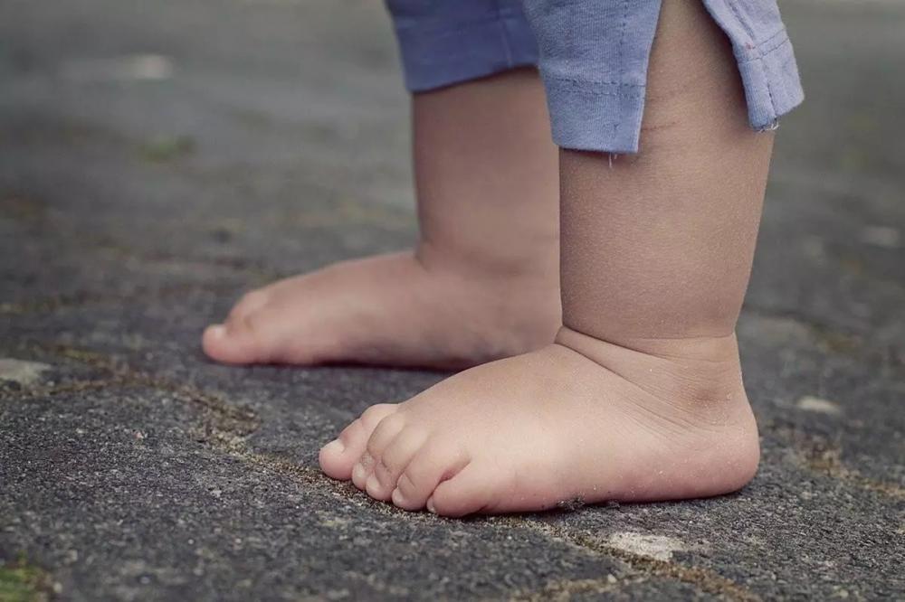 Segunda criança com menos de 4 anos morre por Covid-19 em Belo Horizonte