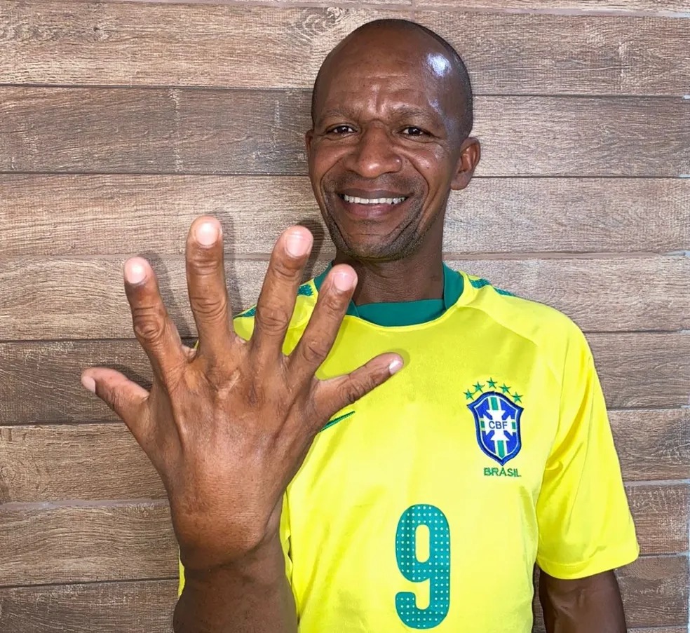 Baiano com seis dedos pretende comemorar hexa da seleção com uma mão só — Foto: Arquivo Pessoal