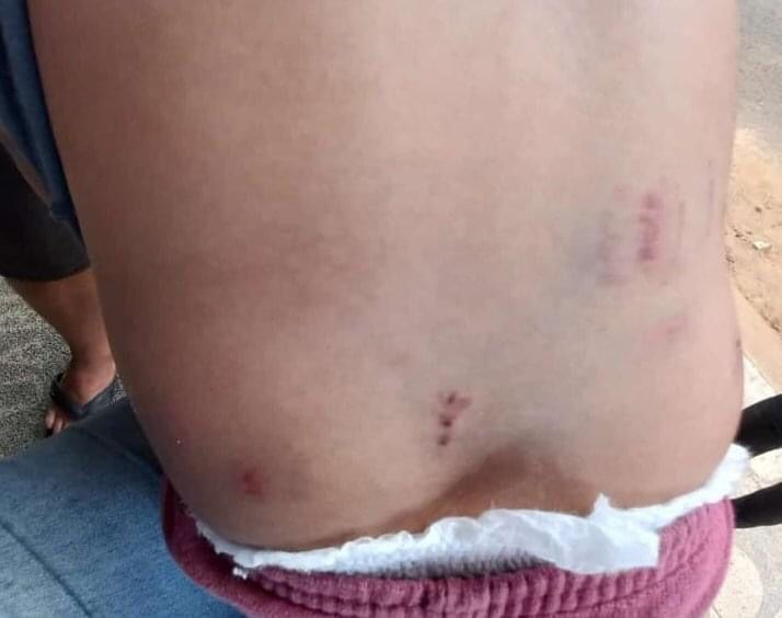 De acordo com a mãe da criança, 23 mordidas foram encontradas no corpo do menino 