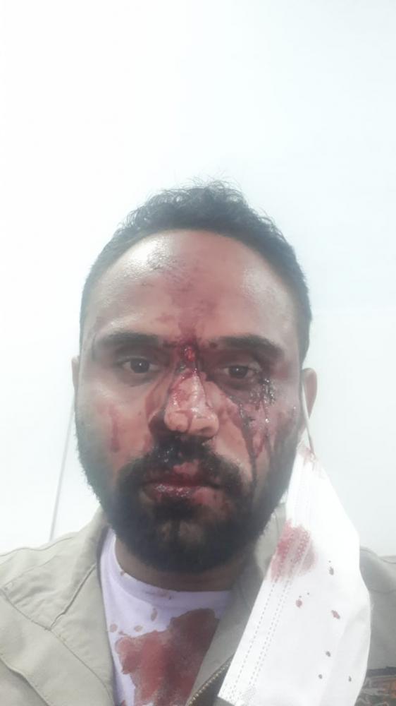 Policial Militar é preso suspeito de agredir motorista de aplicativo, em Santa Luzia, na Grande BH