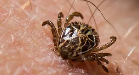 A febre maculosa é uma doença infecciosa aguda transmitida pela picada do carrapato-estrela