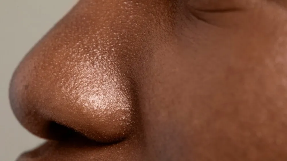 Homem é preso após morder e arrancar parte do nariz da companheira em Minas 