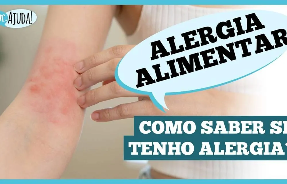 Alergia alimentar: como reconhecer os sinais e quando procurar ajuda