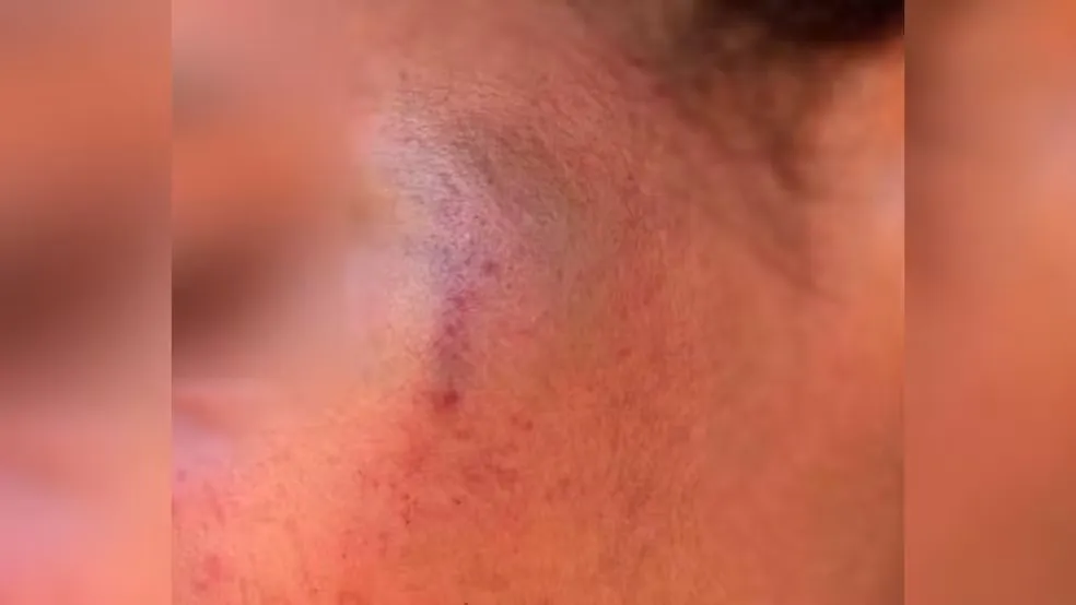 Foto: Reprodução/Patos Hoje