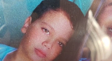 Menino de 11 anos morre após extrair dente em clínica de Igarapé